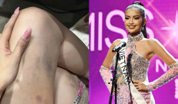 Ngọc Châu để lộ đôi chân bầm tím tại Miss Universe 2022, nói gì sau khi out top 16 chung cuộc?