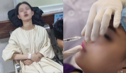 Cô gái trẻ 17 tuổi bị mù vĩnh viễn, liệt não trái sau khi tiêm filler nâng mũi