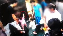 Em bé ở Hà Nội bị kẹp tay vào thang máy chung cư