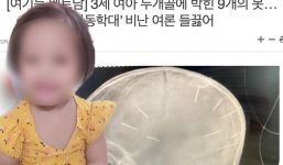 Truyền thông Hàn Quốc đưa tin vụ bé gái 3 buổi nghi bị bạo hành với 9 cây đinh găm vào đầu tại Thạch Thất (Hà Nội)
