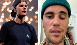 Justin Bieber gây sốc khi bất ngờ tiết lộ bị liệt nửa mặt vì nhiễm virus