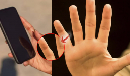 Cầm iPhone quá nhiều khiến ngón tay út biến dạng: Kiểm tra ngay xem bạn có bị không?