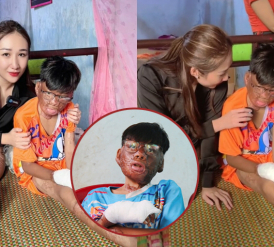 TikToker Huỳnh Như xót xa, hứa sẽ hỗ trợ hết mình cho hoàn cảnh của cậu bé 12 tuổi bỏng nặng vì cứu mẹ