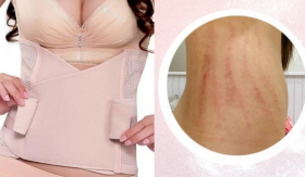Chuyên gia cảnh báo mối nguy khi mặc quần định hình, đồ sinh nhiệt để giảm cân nhanh nhiều chị em lầm tưởng