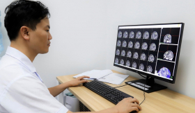 Nam sinh 20 tuổi thường xuyên đau đầu, chóng mặt tưởng bị cảm, đi khám mới phát hiện khối u sâu trong não