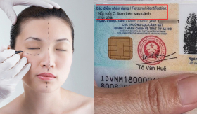 Sau khi phẫu thuật thẩm mỹ trên gương mặt bắt buộc phải làm lại căn cước công dân?