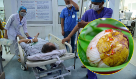 Người đàn ông 34 tuổi ở Quảng Ninh nhập viện sau khi ăn trứng vịt lộn, cảnh báo nguy cơ sức khỏe