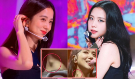 YG thông báo về tình hình sức khỏe của Jisoo (BLACKPINK) sau hình ảnh nữ idol nổi hạch bất thường trên cổ