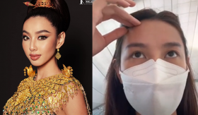 Hậu sự kiện diện trang phục Thái giá hơn 20 tỷ, Thùy Tiên tiết lộ sự cố bị thương vùng đầu khiến fan lo lắng