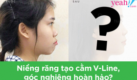 Xu hướng làm đẹp thông minh của giới trẻ: Can thiệp tối thiểu, “thay đổi” tối đa