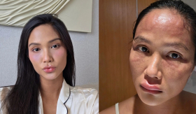 H'Hen Niê lên tiếng về tin đồn ‘biến dạng ngoại hình’ sau khi sinh