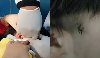 Thấy đốm đen trên đầu con ngỡ nốt ruồi, mẹ đưa đến bệnh viện bác sĩ liền bảo: “Chậm một chút hối hận cả đời”
