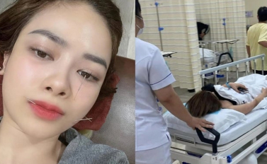 Một nữ ca sĩ Vbiz bị liệt dây thần kinh số 7, phải cấp cứu nửa đêm