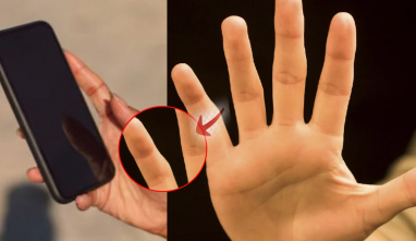 Cầm iPhone quá nhiều khiến ngón tay út biến dạng: Kiểm tra ngay xem bạn có bị không?