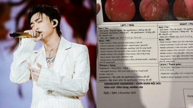 SOOBIN gửi kết quả khám cho fan: bị phù nề, sung huyết mũi họng hậu concert