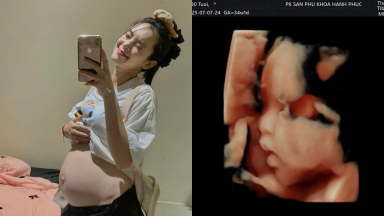 Diễn viên Quỳnh Lương kiệt sức ở tháng thứ 8 thai kỳ lần 2: Đau đớn toàn thân, khó khăn di chuyển