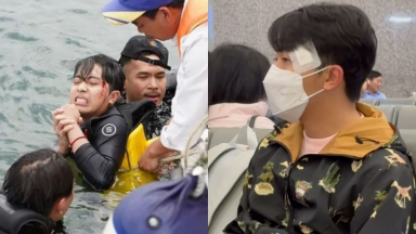 Cris Phan được mẹ Lê Dương Bảo Lâm hỏi thăm ân cần sau tai nạn 'đổ máu', ánh mắt thất thần khiến fan xót xa