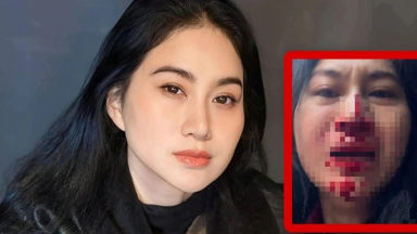 Diễn viên Phi Ngọc Ánh mặt đầy máu, cầu cứu trên livestream