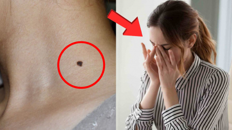 Còn trẻ xuất hiện dấu hiệu da này thì đi khám ngay vì dễ mắc bệnh nguy hiểm