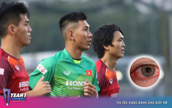 Trước ngày đấu Thái Lan, hàng loạt tuyển thủ Việt Nam bỗng mắc bệnh lạ