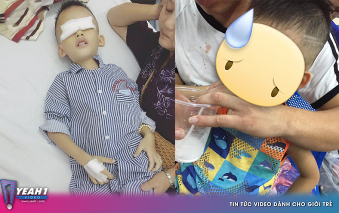 Bé trai lớp 4 phải phẫu thuật cả hai mắt vì thói quen vô tình này của các bậc phụ huynh