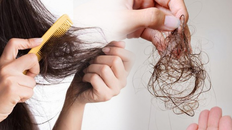 Cơ thể thiếu chất gì khiến tóc bị rụng nhiều? Càng để lâu càng nguy hiểm