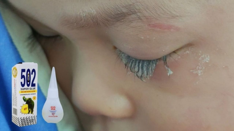 Con trai đổ keo 502 vào mắt, người bố nhanh trí nhỏ thêm thứ này cứu con, kết quả thần kỳ không ngờ