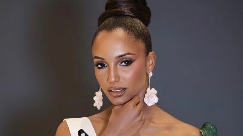 Hoa hậu Jamaica nhập viện cấp cứu