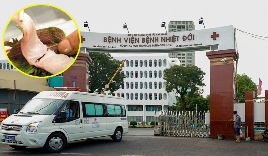 Bệnh viện TP.HCM tiếp nhận nhiều ca bệnh nguy kịch chỉ vì thói quen ăn uống nhiều người mắc phải