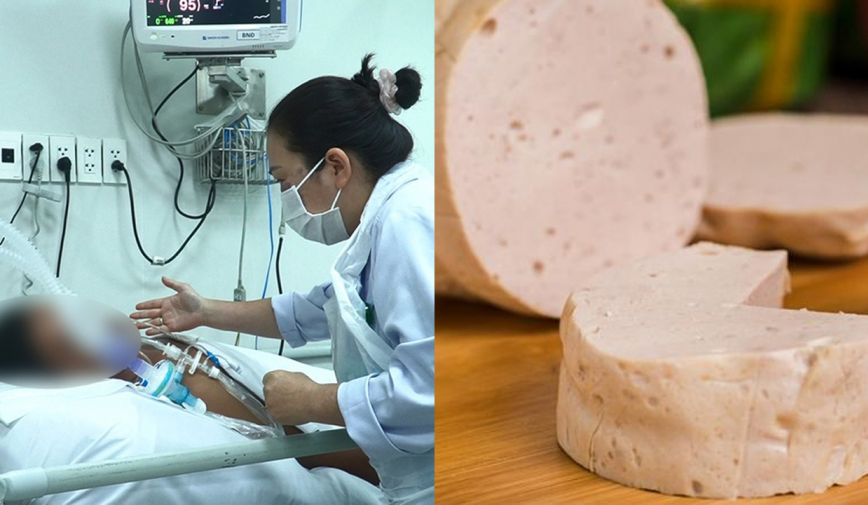 Hai anh em ngộ độc Botulinum liệt cơ, diễn tiến xấu sau 14 ngày nằm viện điều trị