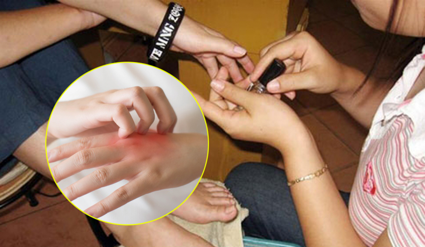 Xôn xao cô gái 2k3 mắc bệnh thế kỷ sau khi đi làm móng về, thực hư thế nào?