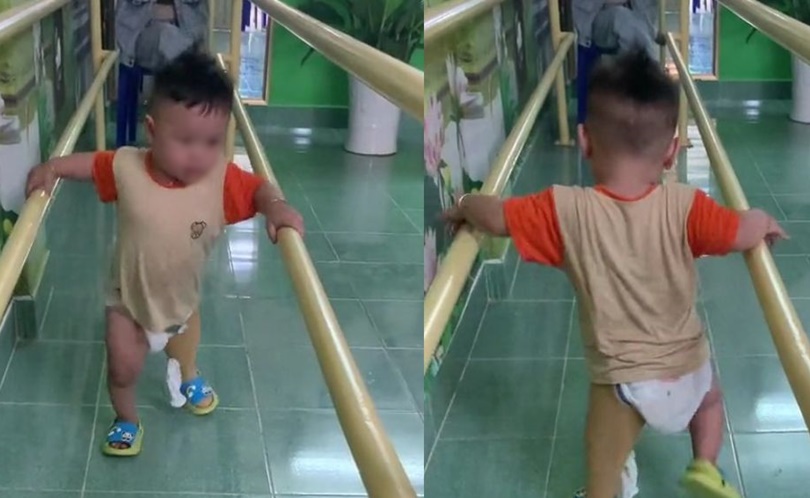 Xúc động hình ảnh cậu bé 3 tuổi tự bước đi trên chiếc chân giả 
