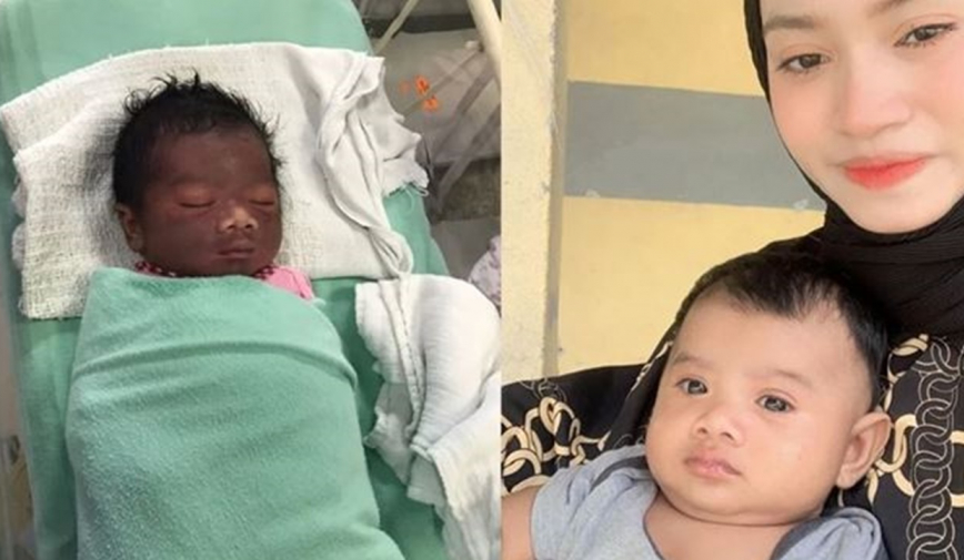 Em bé vừa chào đời có làn da như 'Bao Công' khiến ba mẹ không nhận ra con, 3 tháng sau thay đổi bất ngờ
