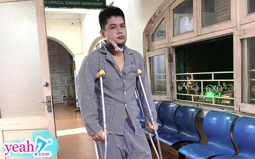 Long Chun rút khỏi 'Gương mặt thân quen' vì phát hiện u men xương hàm, phải phẫu thuật cắt toàn bộ xương hàm dưới