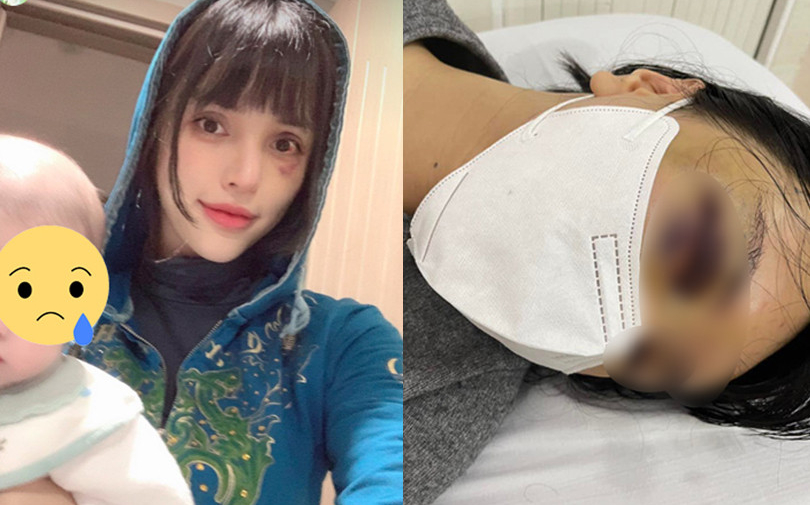 Diện mạo hiện tại của siêu mẫu Khả Trang sau thông tin bị bạo hành, mất tích hơn 1 năm qua