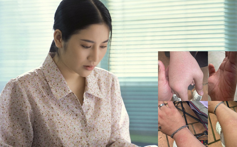 'Ngọc nữ bolero' Tố My và ê kíp bị ong tấn công khi quay MV 'Em mình ơi', 3 người phải nhập viện