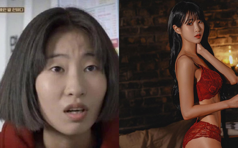 Sao nữ 'Reply 1988' từng bị miệt thị vì ngoại hình kém xinh, lột xác 180 độ sau phẫu thuật