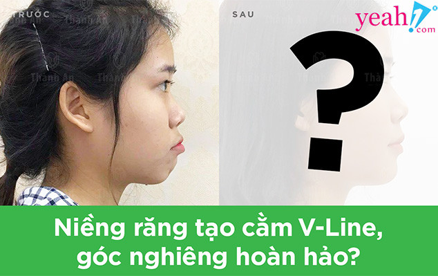 Xu hướng làm đẹp thông minh của giới trẻ: Can thiệp tối thiểu, “thay đổi” tối đa