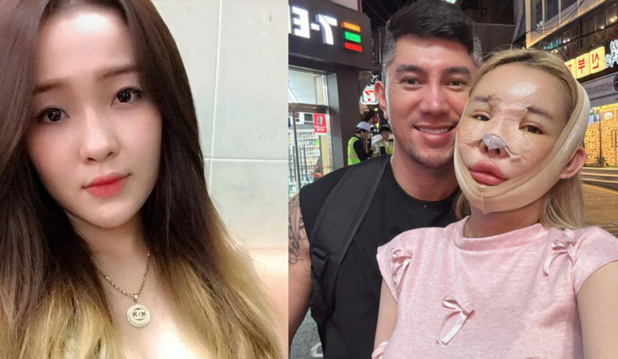 Ngỡ ngàng dung mạo của Ngân 98 trước khi trải qua 12 cuộc phẫu thuật thẩm mỹ